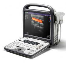 Ультразвуковой сканер S6